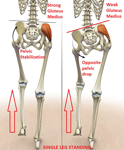 Image of skeleton showing how the gluteus medius affects a hot power yoga practice.